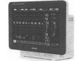 Системы мониторинга пациента IntelliVue (Фото 5)